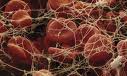 TEST GENETICI PER LA DIAGNOSI DELLE PATOLOGIE TROMBOTICHE 