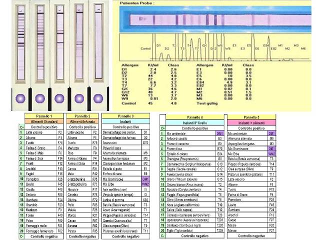 Il Laboratorio Analisi Cliniche Uditore per la determinazione quantitativa delle IgE ...